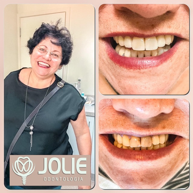 Jolie Implantes Dentista Assefaz